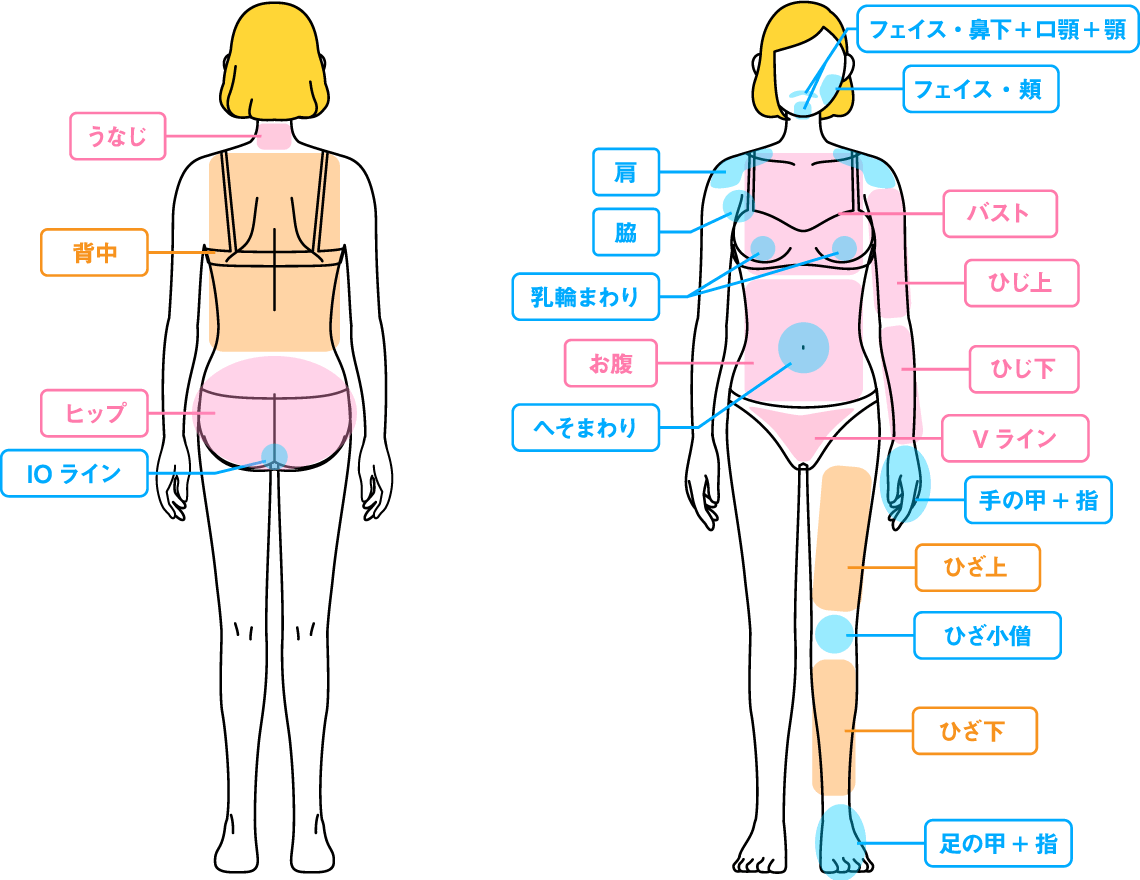 脱毛パーツ 女性
