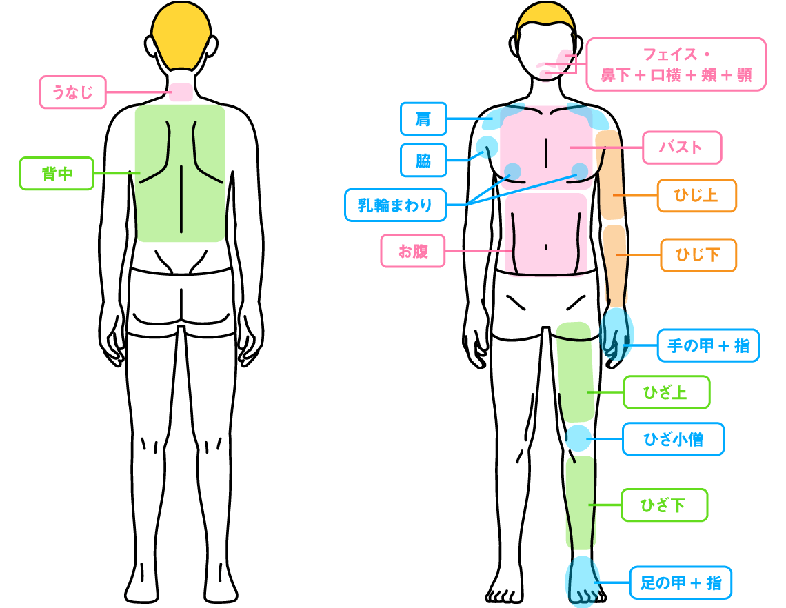 脱毛パーツ 男性